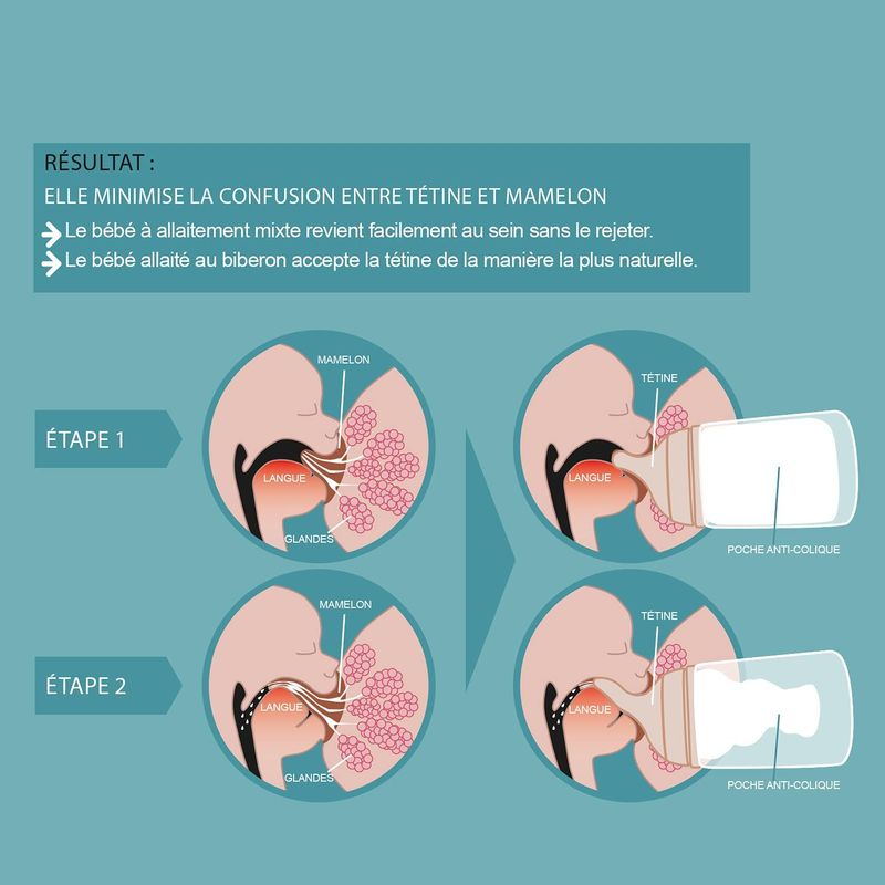 Lot de 2 Tétines Pour Biberon Anti-Colique Zero Zero Débit Lent / S Suavinex explications 3